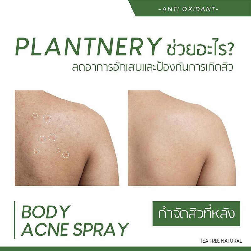 Plantnery สเปรย์ลดสิวสำหรับผิวกาย Tea Tree Body Acne Spray 120มล.