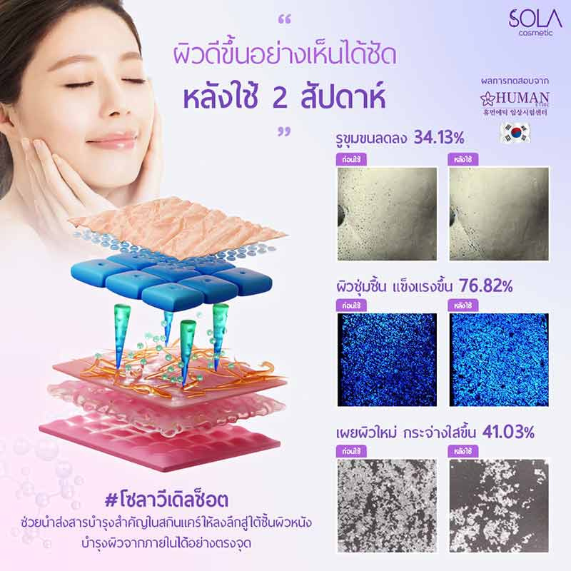 Sola เซรั่มบำรุงผิวหน้า Collagen Veedle Shot 6 มล. (แพ็ก 6 ชิ้น)