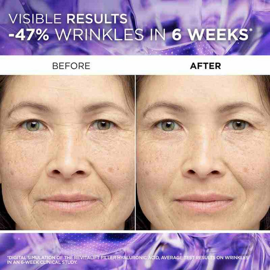 ลอรีอัล รีไวทัลลิฟท์ ไฮยาลูรอนิค แอซิด เซรั่ม 6 ml. (แพ็ก6)