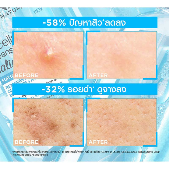 การ์นิเย่ สกิน แนทเชอรัลส์ ไมเซล่า คลีนซิ่ง วอเตอร์ ซาลิไซลิค บีเอชเอ 400 มล.