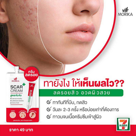 Morika ครีมบำรุงผิว Scar Cream 5 กรัม (แพ็ก 6 ชิ้น)