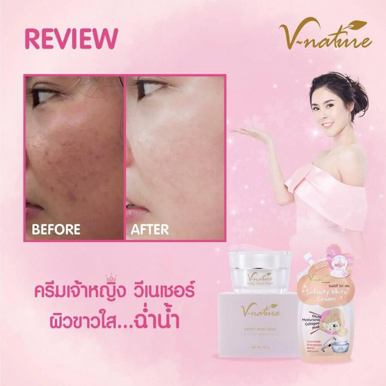 V Nature เซรั่มบำรุงผิวหน้า Infinity White Serum 10 กรัม (แพ็ก6)