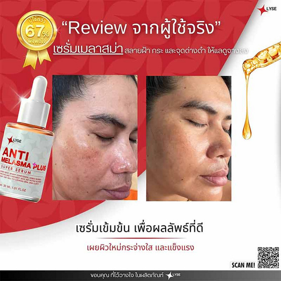 LYSE เซรั่มบำรุงผิวหน้า Anti Melasma Plus Super Serum 30 มล.