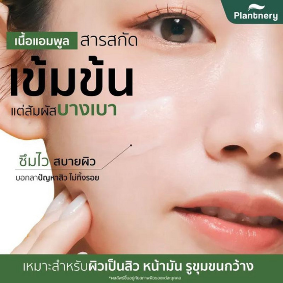 Plantnery เซรั่มเข้มข้น Red Onion Anti-Acne Ampoule Dose Serum 8 มล. (6 ซอง)