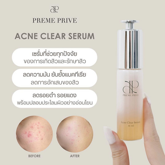 Preme Prive เซรั่มบำรุงผิวหน้า Acne Clear Serum 30 มล.