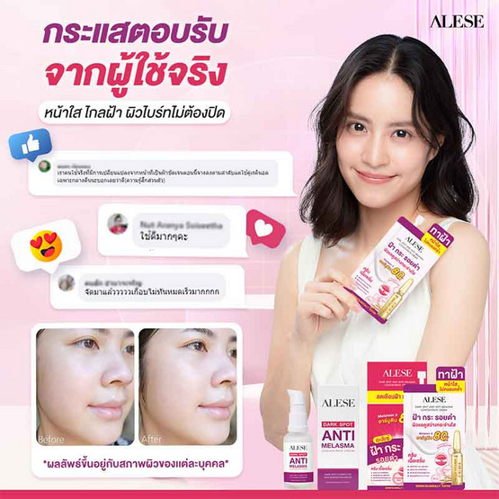 Alese ครีมบำรุงผิวหน้า Dark Spot Anti-Melasma Concentrate Cream 7 กรัม (6ซอง)