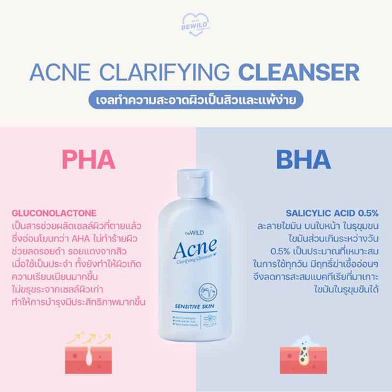 beWiLD เจลทำความสะอาดผิวหน้า Acne Clarifying Cleanser 100 มล.