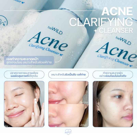 beWiLD เจลทำความสะอาดผิวหน้า Acne Clarifying Cleanser 100 มล.