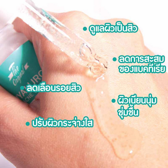 The Original เซรั่มลดสิว Hyaluron Acne Expert 10 มล.