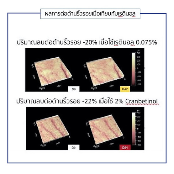 Dr.ceuracle น้ำตบเอสเซ้นส์ Vegan Active Berry First Essence 150มล.