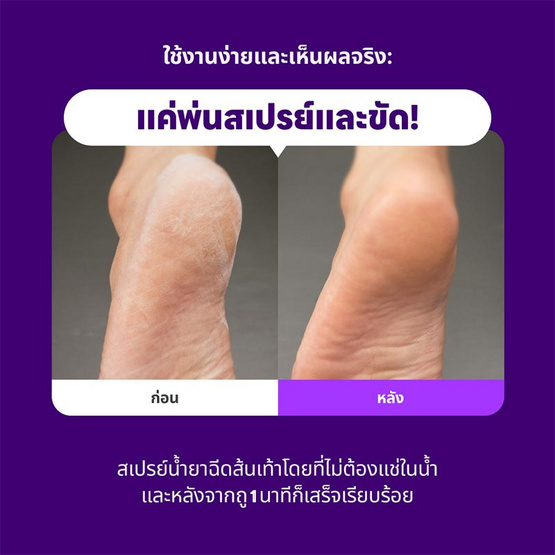 BAREN ชุดขัดส้นเท้า Baren Foot Softener At-Home Kit