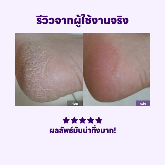 BAREN ชุดขัดส้นเท้า Baren Foot Softener At-Home Kit