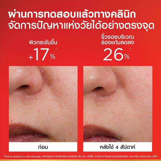 ลอรีอัล รีไวทัลลิฟท์ แอดวานซ์ แอนตี้-ริงเคิล เฟิร์มมิ่ง เฟเชียล เดย์ครีม 50 มล. ลอรีอัล รีไวทัลลิฟท์ แอดวานซ์ แอนตี้-ริงเคิล เฟิร์มมิ่ง เฟเชียล เดย์ครีม 50 มล.