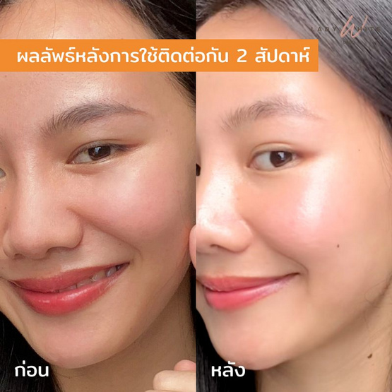 LADY WHITE by BD สบู่ล้างหน้า VIT C Aura Soap 80 กรัม (แพ็กคู่) LADY WHITE by BD สบู่ล้างหน้า VIT C Aura Soap 80 กรัม (แพ็กคู่)