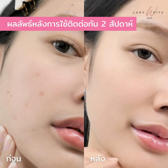 LADY WHITE by BD สบู่ล้างหน้า Aloe Vera Aura Soap 65 กรัม (แพ็กคู่)