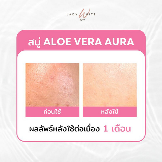 LADY WHITE by BD สบู่ล้างหน้า Aloe Vera Aura Soap (Premium) 70 กรัม (แพ็กคู่)