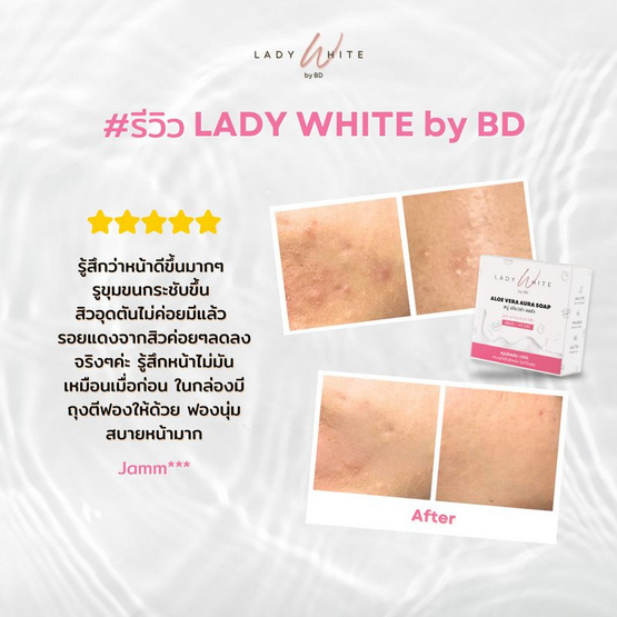 LADY WHITE by BD สบู่ล้างหน้า Aloe Vera Aura Soap (Premium) 70 กรัม (แพ็กคู่)