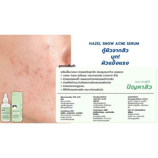 Fuji Cream เซรั่มบำรุงผิวหน้า Hazel Snow Acne Serum 50กรัม Fuji Cream เซรั่มบำรุงผิวหน้า Hazel Snow Acne Serum 50กรัม
