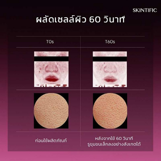 Skintific เอเฮชเอ บีเฮชเอ พีเฮชเอ แอลเฮชเอ พีลลิ่ง โซลูชั่น 30 มล.