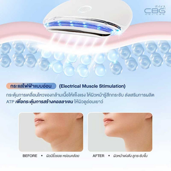 CBG Devices เครื่องนวดกัวซายกกระชับ Guasha Beam CBG Devices เครื่องนวดกัวซายกกระชับ Guasha Beam
