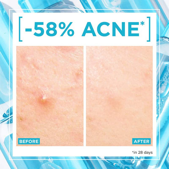 การ์นิเย่ ไมเซลล่า ซาลิไซลิค บีเอชเอ 50 มล. (แพ็ก 3 ชิ้น) การ์นิเย่ ไมเซลล่า ซาลิไซลิค บีเอชเอ 50 มล. (แพ็ก 3 ชิ้น)