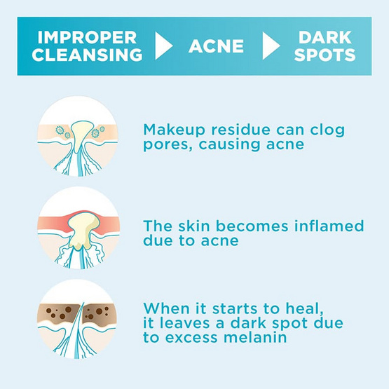 การ์นิเย่ ไมเซลล่า ซาลิไซลิค บีเอชเอ 50 มล. (แพ็ก 3 ชิ้น) การ์นิเย่ ไมเซลล่า ซาลิไซลิค บีเอชเอ 50 มล. (แพ็ก 3 ชิ้น)