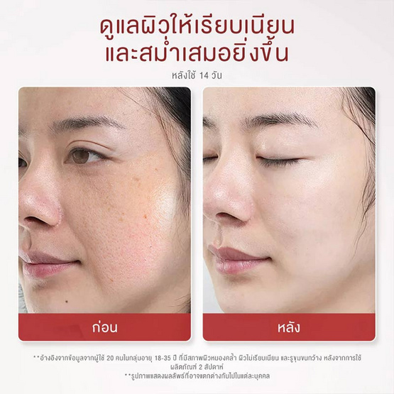 Glad2Glow เอเฮชเอ บีเฮชเอ พีเฮชเอ อินเท็นซีฟ พีลลิ่ง โซลูชั่น 15 มล.