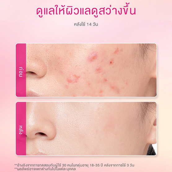 Glad2Glow พีช เรตินอล มอยเจอร์ไรเซอร์ 30 กรัม