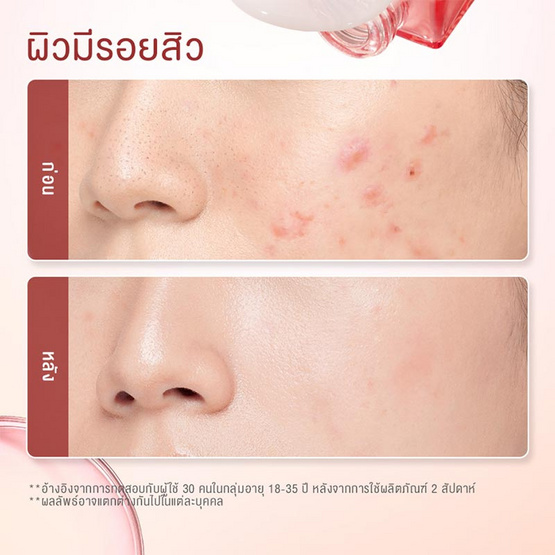 Glad2Glow โพเมเกรเนต ไนอะซินาไมด์ พาวเวอร์ ไบรท์ เซรั่ม 17 มล.