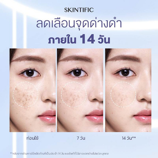 Skintific ซิมไวท์ 377 ดาร์ก สปอต เซรั่ม 7 มล. (แพ็ก 6 ซอง)