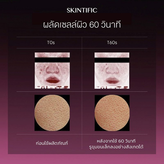 Skintific เอเฮชเอ บีเฮชเอ พีเฮชเอ แอลเฮชเอ พีลลิ่ง โซลูชั่น 10 มล. (แพ็ก 6 ซอง)
