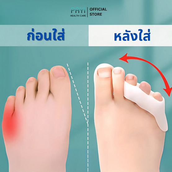PAYI HEALTH CARE ซิลิโคนแยกนิ้วเท้า ลดเสียดสี Free Size 34-45