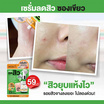 Merci เซรั่มลดสิว Vitamin C Anti-Acne Extra Bright Serum 4กรัม (แพ็ก 6 ซอง)