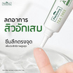 Plantnery เจลแต้มสิวสูตรเร่งด่วน Tea Tree Intense Acne Spot Gel 15 กรัม