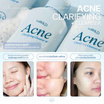 beWiLD เจลทำความสะอาดผิวหน้า Acne Clarifying Cleanser 100 มล.