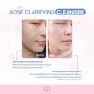 beWiLD เจลทำความสะอาดผิวหน้า Acne Clarifying Cleanser 100 มล.