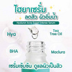 The Original เซรั่มลดสิว Hyaluron Acne Expert 10 มล.