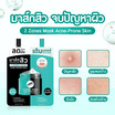 The Original มาส์กสิว 2 Zones Mask Acne-Prone Skin 6+6 กรัม แพ็ก 6 ชิ้น