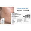 Fuji Cream เซรั่มบำรุงผิวหน้า Hazel Snow Melasma Serum 50กรัม