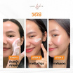 LADY WHITE by BD สบู่ล้างหน้า VIT C Aura Soap 80กรัม (แพ็ก4)