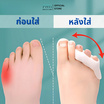 PAYI HEALTH CARE ซิลิโคนแยกนิ้วเท้า ลดเสียดสี Free Size 34-45